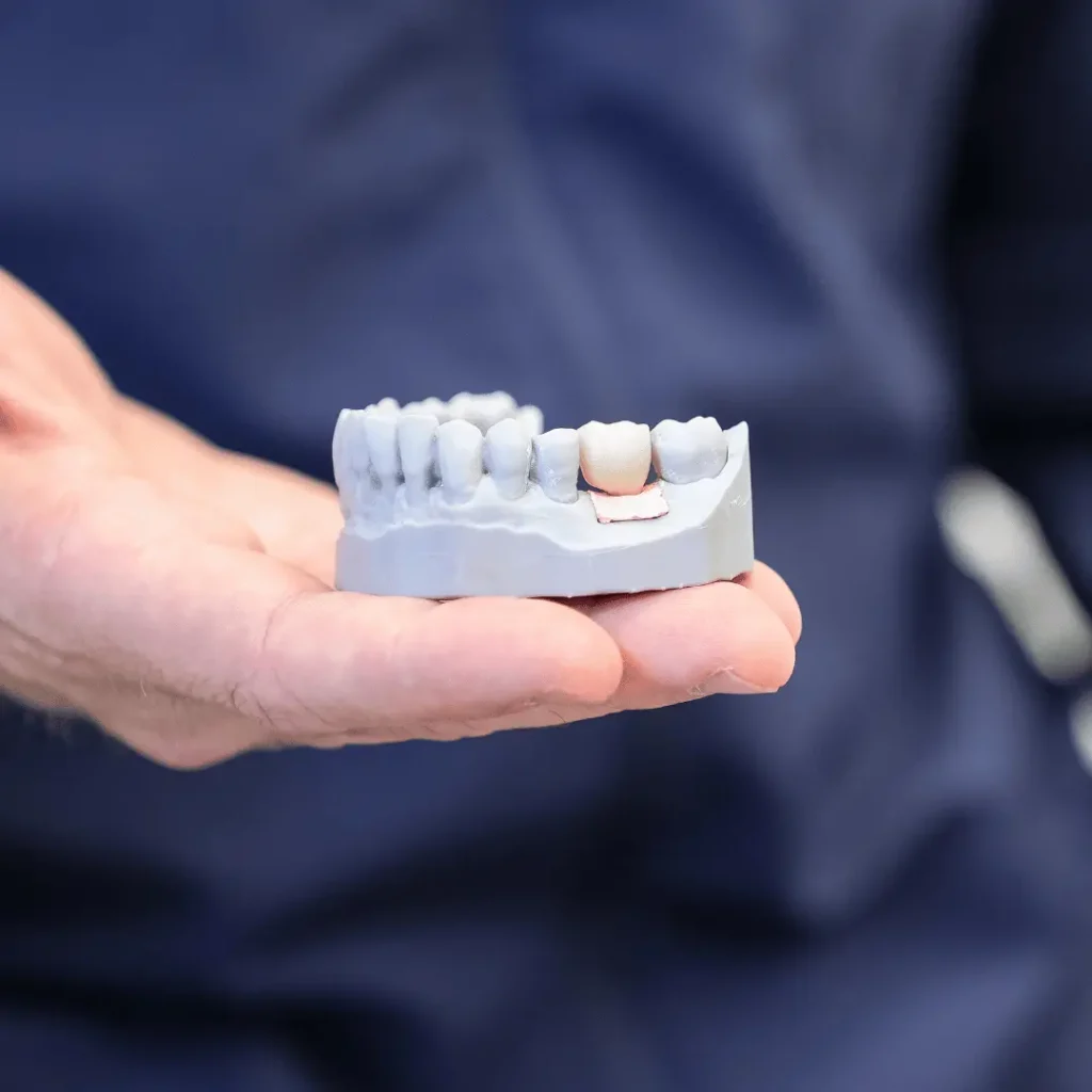 Studio dentistico a Desio 38 impianto dentale a Macherio